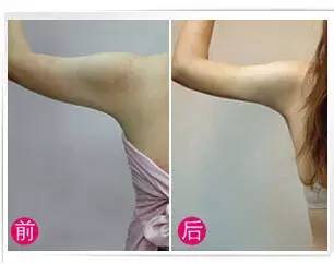 https://img.miyanlife.com/mnt/timg/180906/120I42338-7.jpg