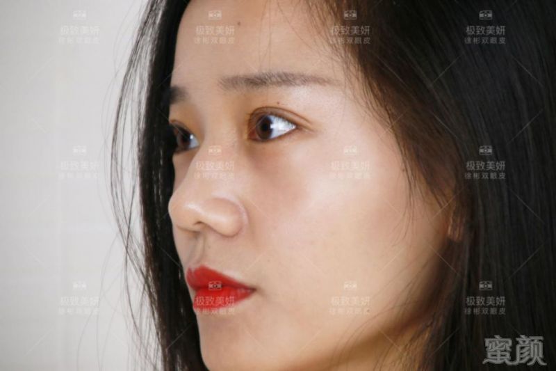 https://img.miyanlife.com/mnt/timg/180906/120U01150-9.jpg
