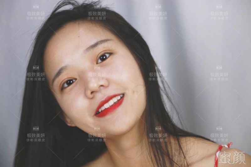 https://img.miyanlife.com/mnt/timg/180906/120U02S2-7.jpg