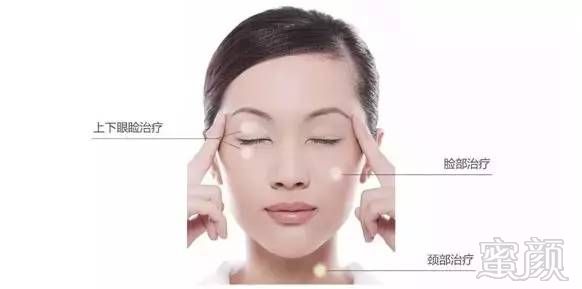 https://img.miyanlife.com/mnt/timg/180906/1211105027-10.jpg