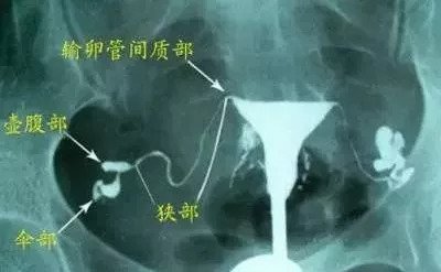 https://img.miyanlife.com/mnt/timg/180906/122K334P-0.jpg