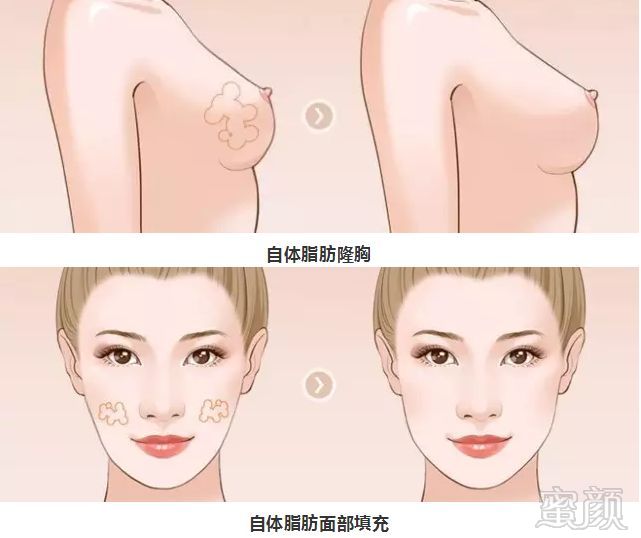 https://img.miyanlife.com/mnt/timg/180906/1233014106-14.jpg