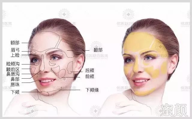 https://img.miyanlife.com/mnt/timg/180906/1234444245-0.jpg