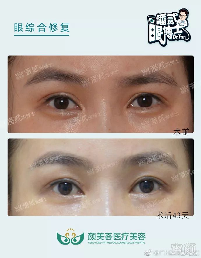 https://img.miyanlife.com/mnt/timg/180906/123K430E-3.jpg
