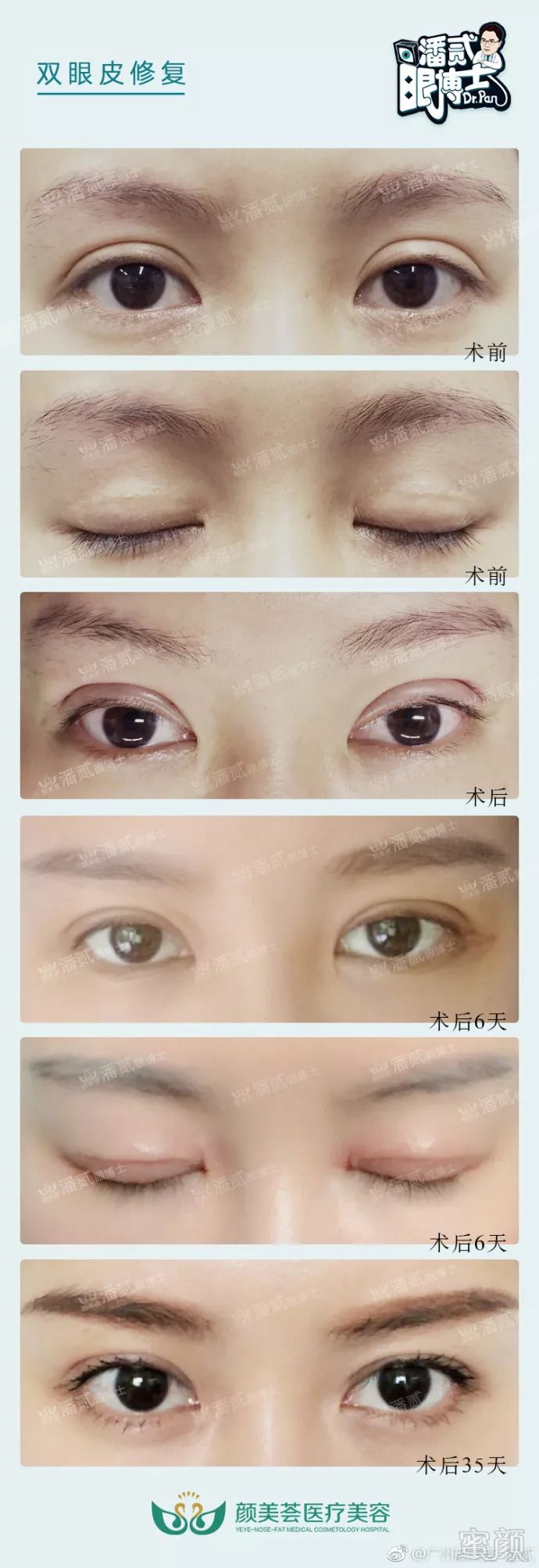 https://img.miyanlife.com/mnt/timg/180906/123K45231-0.jpg