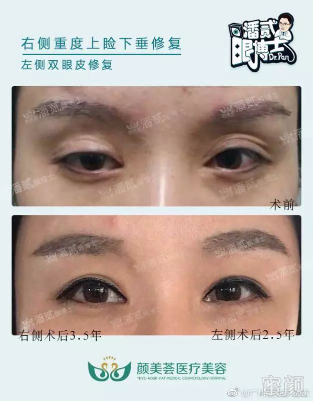 https://img.miyanlife.com/mnt/timg/180906/123K51450-5.jpg