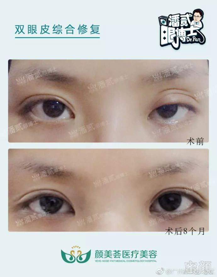 https://img.miyanlife.com/mnt/timg/180906/123K514C-8.jpg