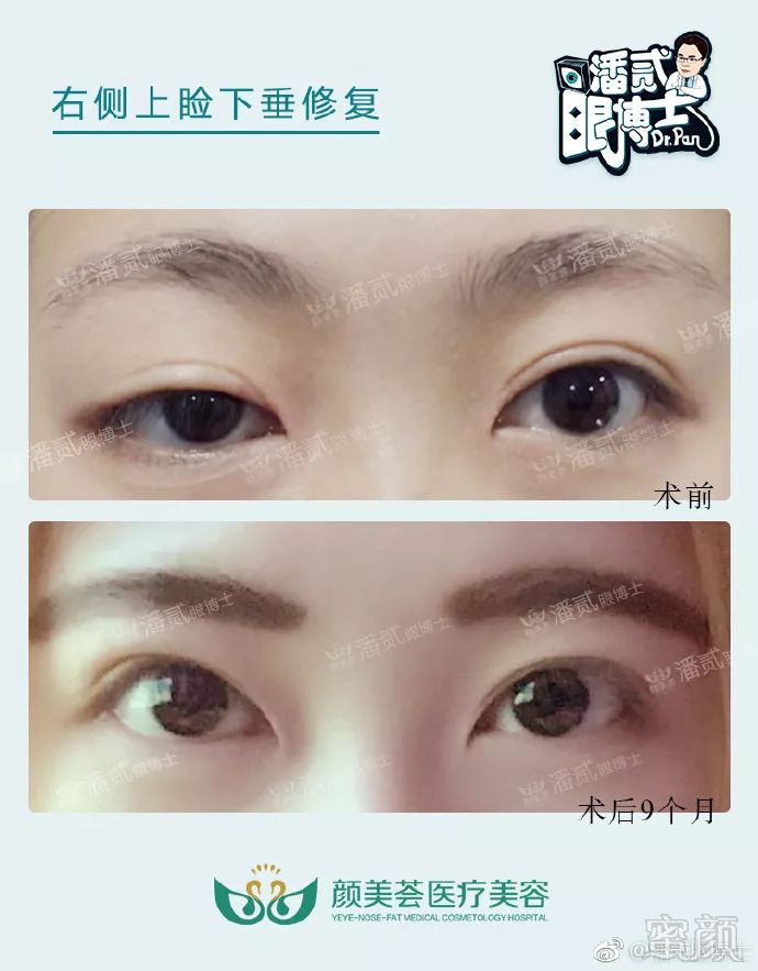 https://img.miyanlife.com/mnt/timg/180906/123K541U-9.jpg