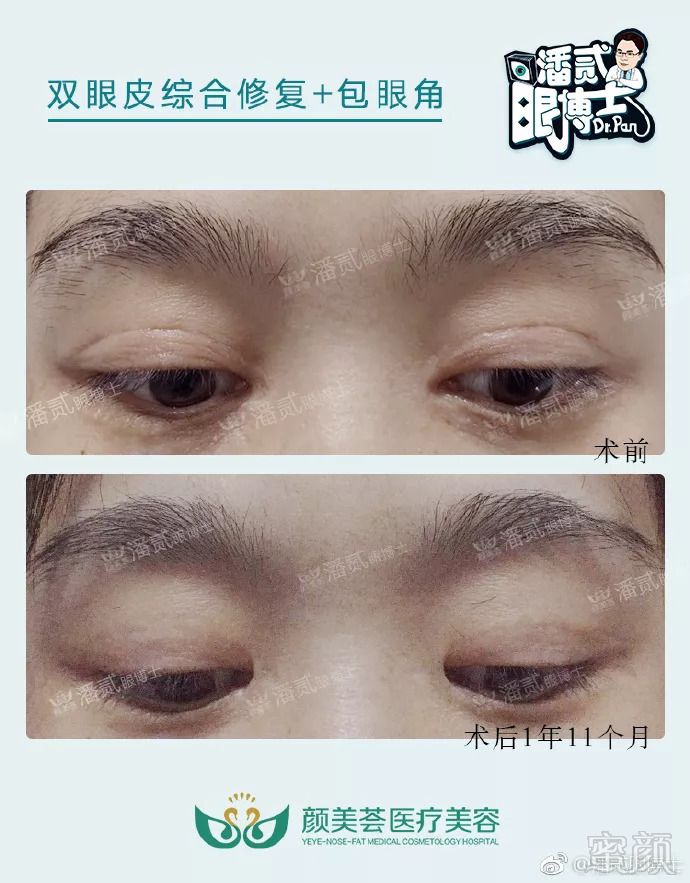 https://img.miyanlife.com/mnt/timg/180906/123K56339-7.jpg
