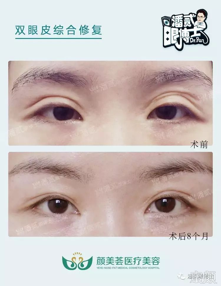 https://img.miyanlife.com/mnt/timg/180906/123K5OU-4.jpg