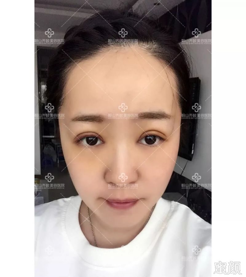 https://img.miyanlife.com/mnt/timg/180906/12502414U-7.jpg