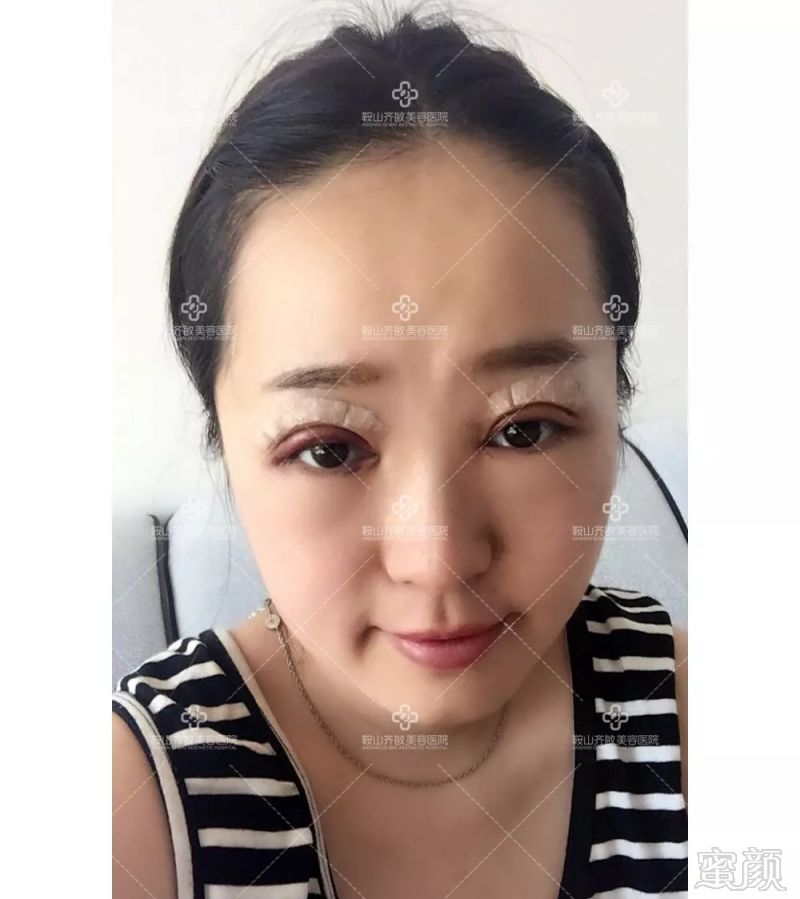 https://img.miyanlife.com/mnt/timg/180906/1250242a3-6.jpg