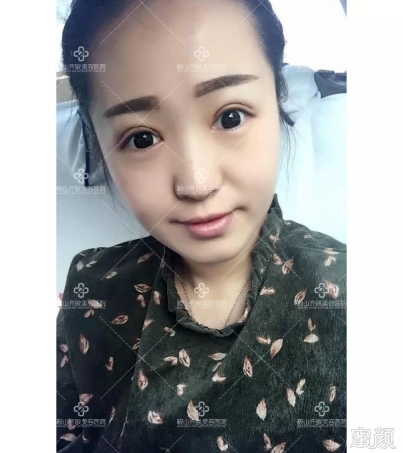 https://img.miyanlife.com/mnt/timg/180906/1250244C3-8.jpg