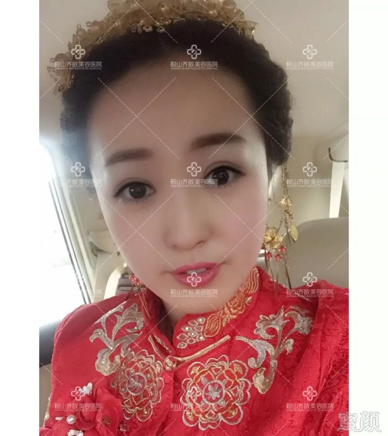 https://img.miyanlife.com/mnt/timg/180906/1250253G9-9.jpg