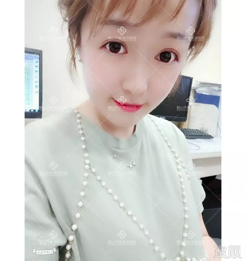 https://img.miyanlife.com/mnt/timg/180906/1250253K2-10.jpg