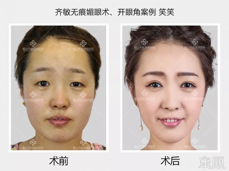 https://img.miyanlife.com/mnt/timg/180906/125025JK-11.jpg