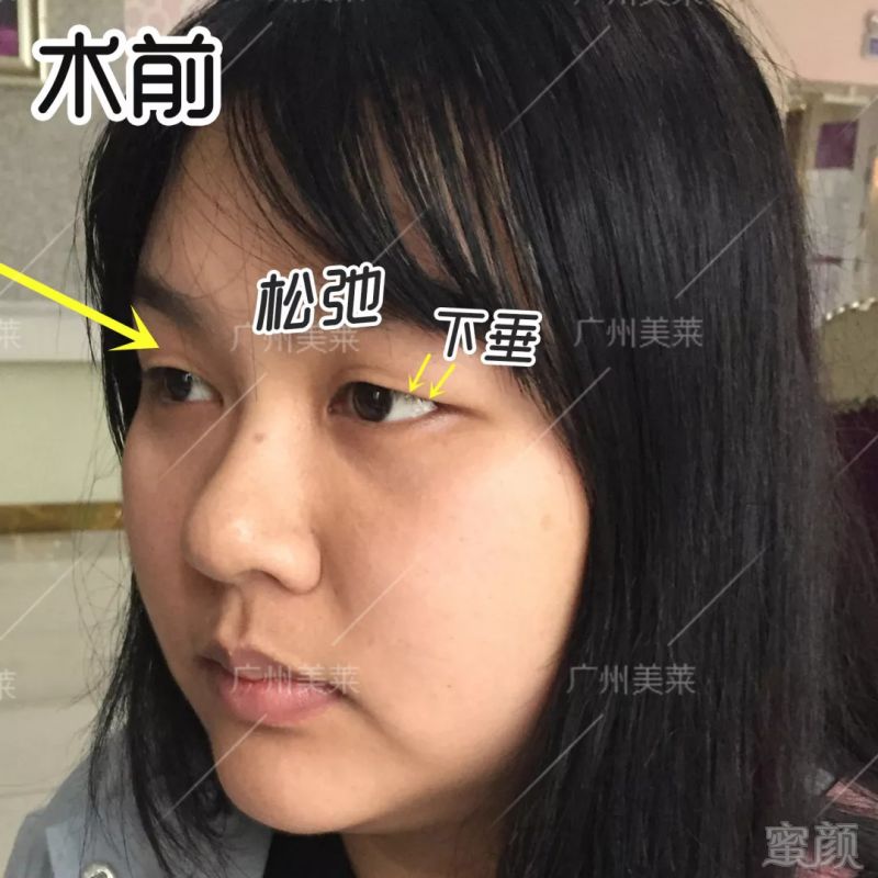 https://img.miyanlife.com/mnt/timg/180906/12510940U-3.jpg