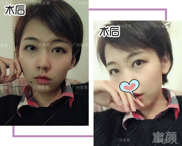 https://img.miyanlife.com/mnt/timg/180906/1251095315-1.jpg
