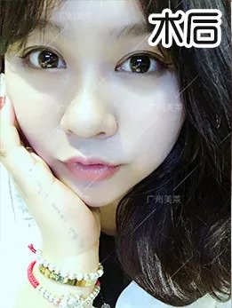 https://img.miyanlife.com/mnt/timg/180906/1251106196-5.jpg