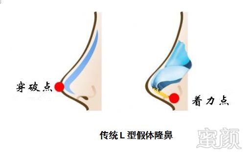 https://img.miyanlife.com/mnt/timg/180906/125319B48-3.jpg