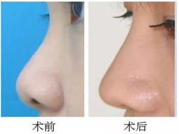 https://img.miyanlife.com/mnt/timg/180906/12531aD0-10.jpg