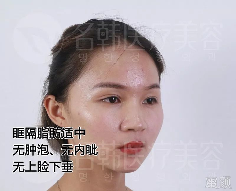 https://img.miyanlife.com/mnt/timg/180906/1254211151-6.jpg