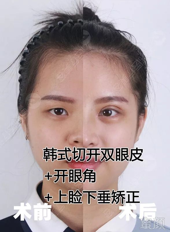 https://img.miyanlife.com/mnt/timg/180906/1254221128-14.jpg