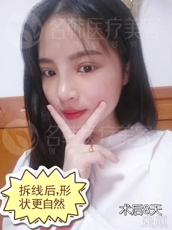 https://img.miyanlife.com/mnt/timg/180906/1254222053-15.jpg