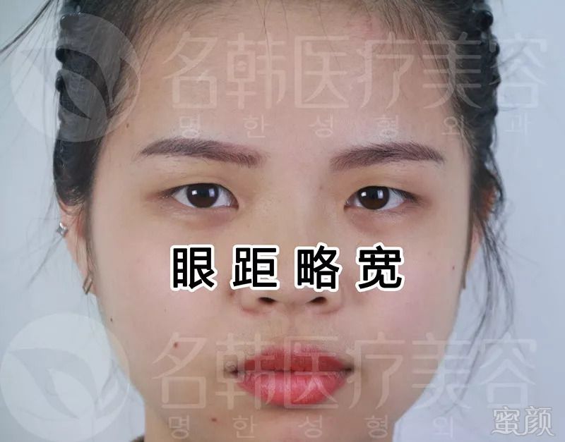 https://img.miyanlife.com/mnt/timg/180906/1254224Z0-13.jpg