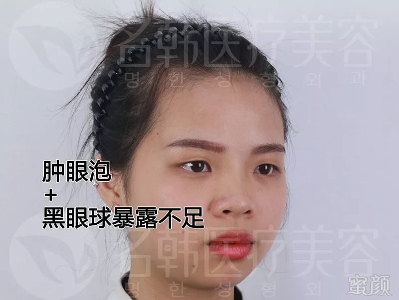 https://img.miyanlife.com/mnt/timg/180906/125422C44-12.jpg