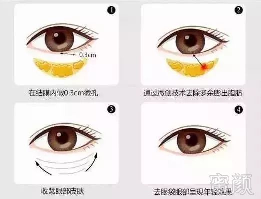 https://img.miyanlife.com/mnt/timg/180906/130202BZ-5.jpg