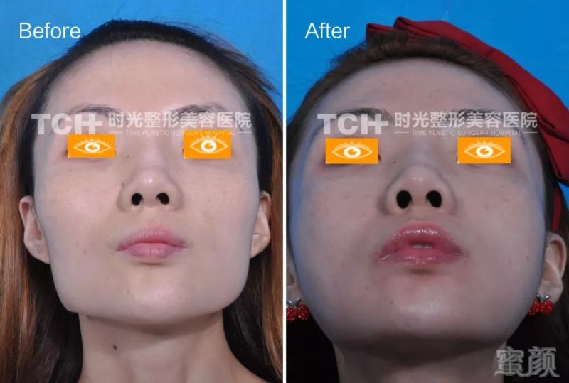 https://img.miyanlife.com/mnt/timg/180906/13030315Y-5.jpg