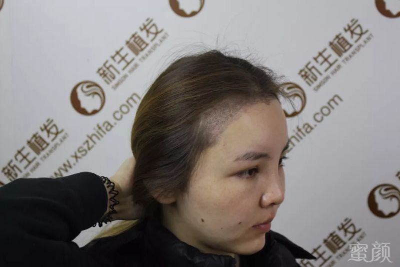 https://img.miyanlife.com/mnt/timg/180906/13062BG7-5.jpg