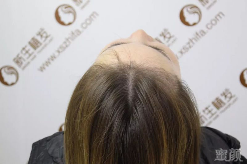 https://img.miyanlife.com/mnt/timg/180906/13062BQ0-3.jpg
