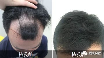 https://img.miyanlife.com/mnt/timg/180906/130I22c4-1.jpg