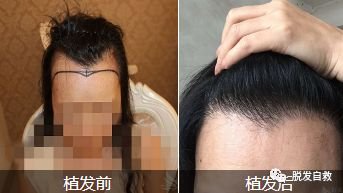 https://img.miyanlife.com/mnt/timg/180906/130I24610-3.jpg