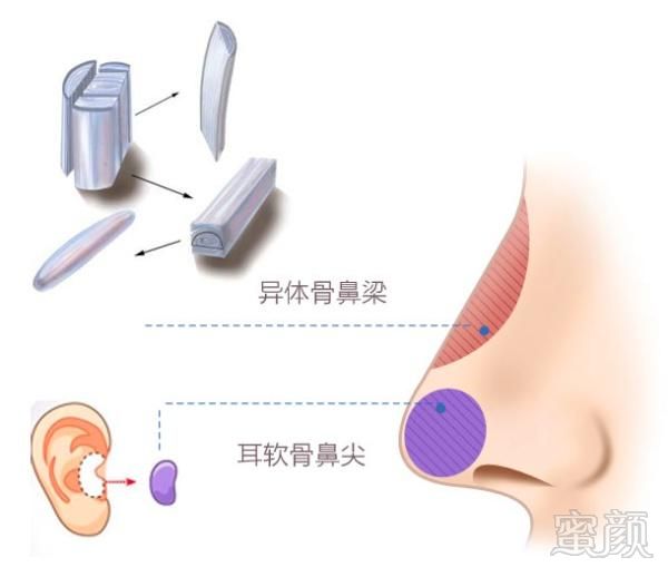 案例图片