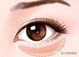 https://img.miyanlife.com/mnt/timg/180907/1105313248-6.jpg