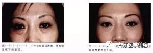 https://img.miyanlife.com/mnt/timg/180907/1105315492-7.jpg