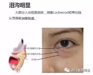 https://img.miyanlife.com/mnt/timg/180907/1105315M2-4.jpg