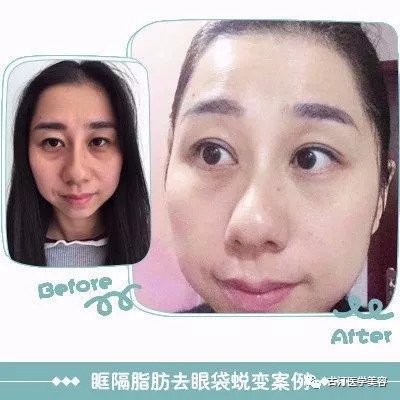 https://img.miyanlife.com/mnt/timg/180907/110532Ab-10.jpg