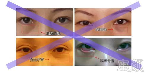 https://img.miyanlife.com/mnt/timg/180907/110G64563-4.jpg