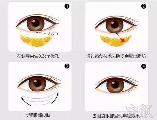 https://img.miyanlife.com/mnt/timg/180907/110GB517-5.jpg