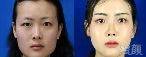 https://img.miyanlife.com/mnt/timg/180907/110U4J21-5.jpg