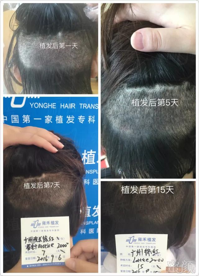 https://img.miyanlife.com/mnt/timg/180907/111H2L61-3.jpg