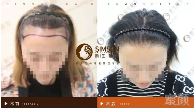 https://img.miyanlife.com/mnt/timg/180907/1120553J7-2.jpg