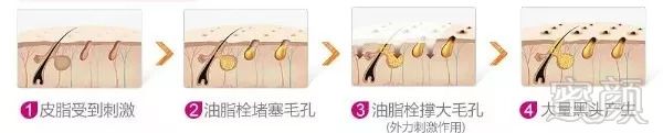https://img.miyanlife.com/mnt/timg/180907/1129464V2-3.jpg
