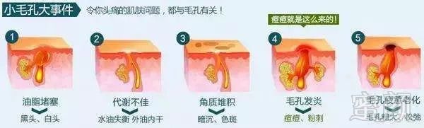 https://img.miyanlife.com/mnt/timg/180907/11294BH8-2.jpg