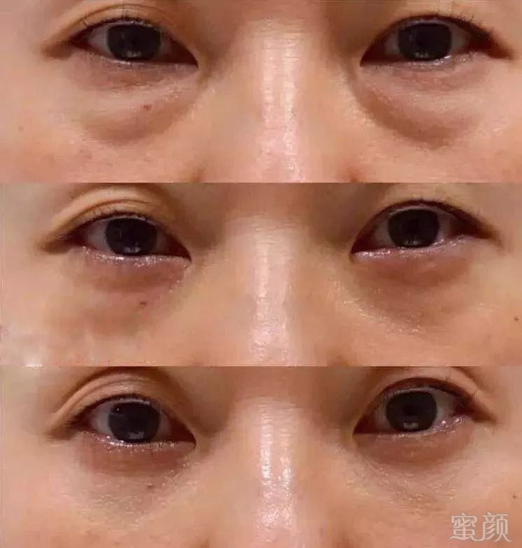 https://img.miyanlife.com/mnt/timg/180907/1132404056-14.jpg