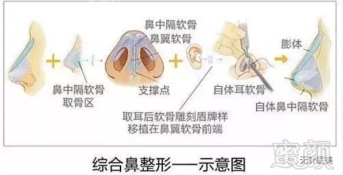 https://img.miyanlife.com/mnt/timg/180907/1159212404-1.jpg